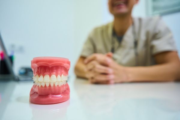 When You May Benefit From Clear Braces Over Clear Aligners
