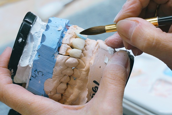 An A To Z Guide To Full Mouth Reconstruction